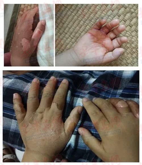 ���ۣ����uһ�׃���@�H�������p�և�(y��n)����͑Ƥ���׃��@����������wԭ��